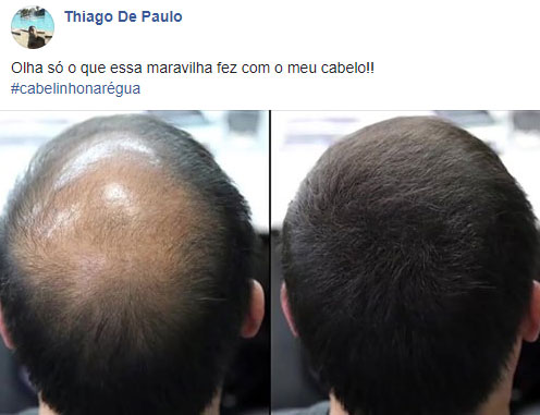 Hair Power